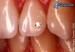 [obrazky.4ever.sk] piercing, zuby, diamanat 6571902.jpg